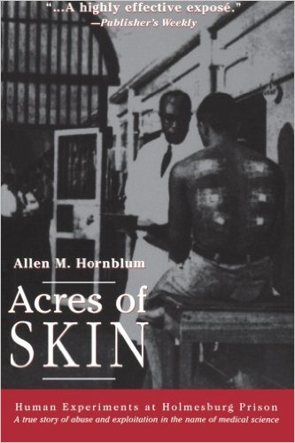 Acres of Skin by Allen M. Hornblum